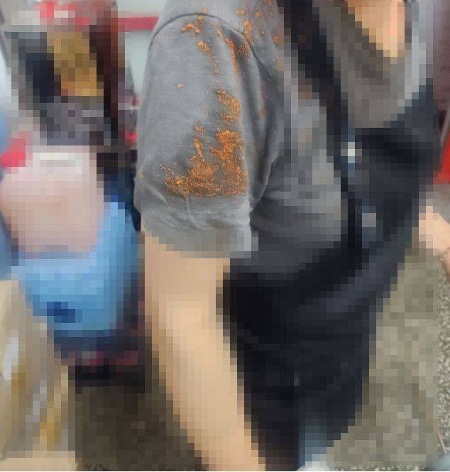 [서울=뉴시스] A씨 어머니가 고객이 던진 떡볶이에 맞은 것으로 보이는 사진.(사진=아프니까 사장이다 갈무리) *재판매 및 DB 금지