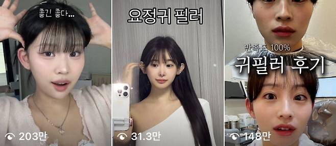 귀 필러 후기 영상들 [인스타그램 캡처. 재판매 및 DB 금지]