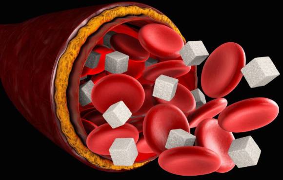 설탕에 절인 통조림 체리는 피하는 것이 바람직하다. 사진은 본 기사 내용과 무관. [사진=humrahi]