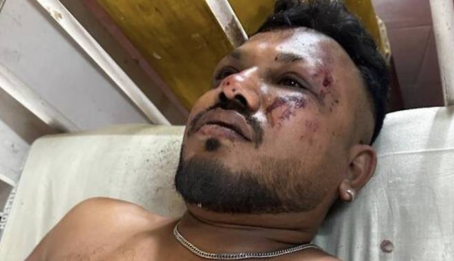 (서울=뉴스1) 김지완 기자 = 12일(현지시간) 인도 서부 구자라트주 아마다바드에 발생한 에어인디아 항공기 추락 사고의 유일한 생존자인 라메시 비스와시쿠마르(40). <출처=힌두스탄타임스 기사 갈무리>