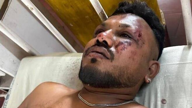 인도 여객기 추락 사고 생존자인 비슈와시 쿠마르 라메시./힌두스탄타임스 보도 캡처