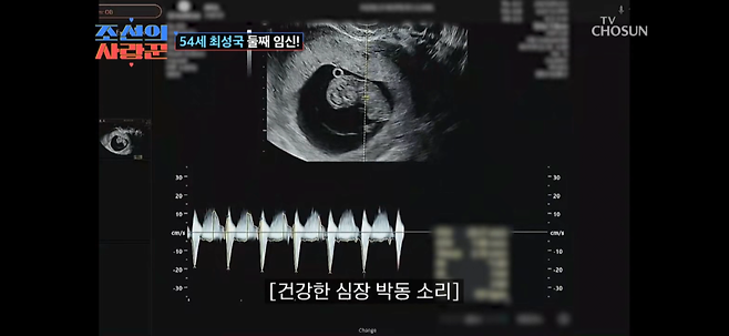 KakaoTalk_20250613_221755348_06.png 최성국 54세에 둘째 임신성공.jpg