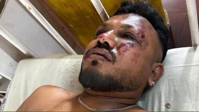 에어인디아 추락 사고에서 살아남은 유일한 탑승자 비슈와시 쿠마르 라메시. 힌두스탄 타임스