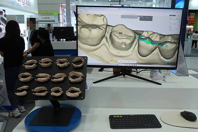 AI 기반 3D 캐드 소프트웨어 이마고웍스 덴트버드 / 출처=IT동아