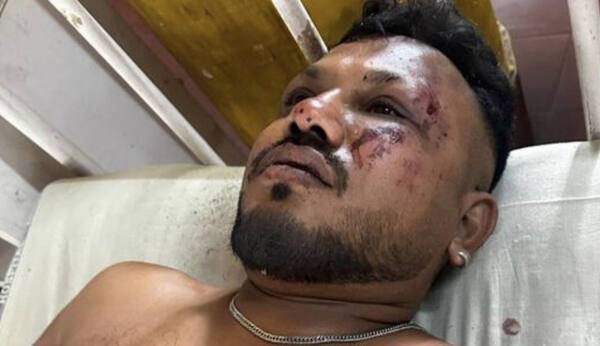 인도 서부 아메다바드 공항 에어인디아 항공기 추락 사고의 유일한 생존자인 비쉬와시 쿠마르 라메쉬(40). 힌두스탄타임스 기사 갈무리