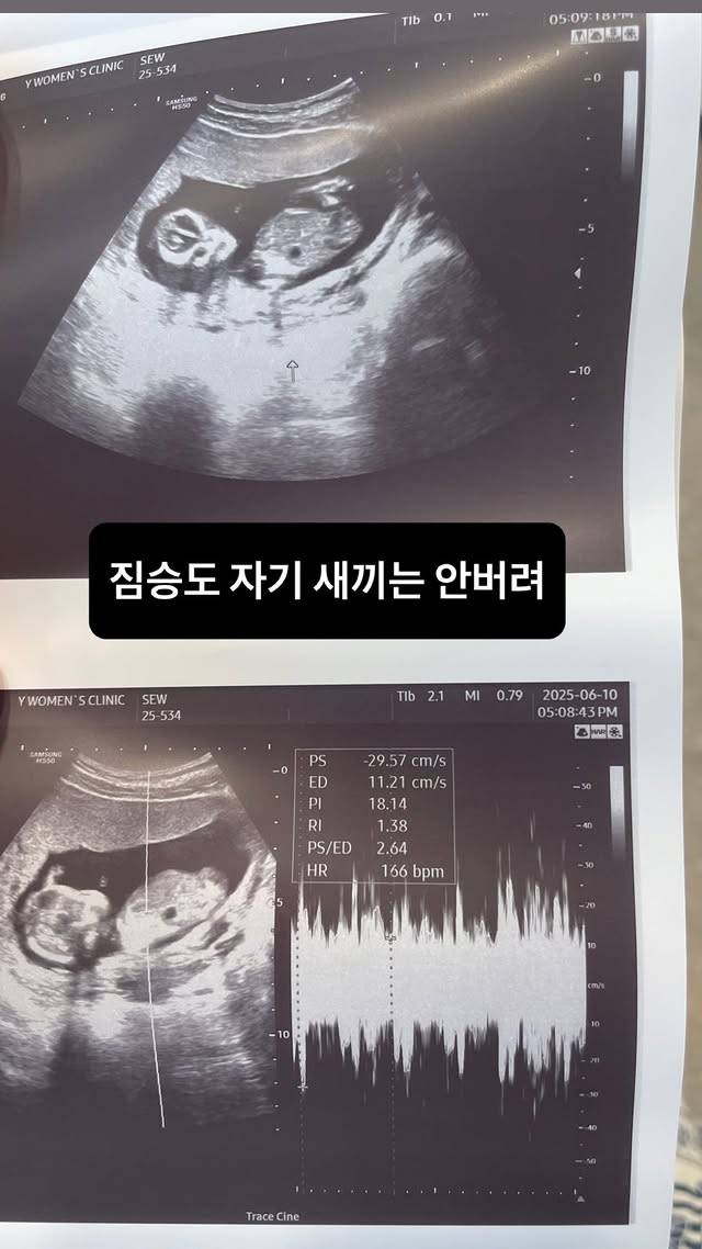 /사진=서민재 SNS