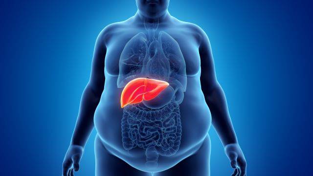 지방간염은 단순한 간 질환이 아니라 전신 건강에 영향을 미치는 만성 대사질환으로 접근해야 한다 | 출처 : 클립아트코리아