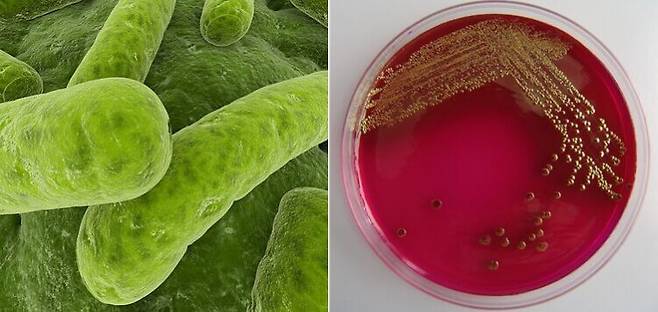 미생물을 염색해 전자현미경으로 촬영한 모습(왼쪽). 미생물을 배지에 배양하면 항생제를 적용한 미생물은 자라지 않고 사멸하는데, 다양한 항생물제에 내성이 있는 수퍼버그를 배양하면 잘 자란다. [사진=게티이미지뱅크]