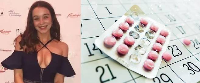 건강했던 20대 여성이 피임약 부작용으로 뇌졸중을 진단받았다. 출처=더선