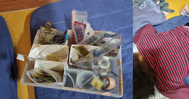 전국을 돌며 무면허 침 시술을 하다가 제주도 자치경찰단에 구속된 70대 남성 피의자가 사용한 침과 반창고 등 도구(왼쪽)와 피의자에게 침 시술을 받는 환자 모습. 제주도 자치경찰단 제공