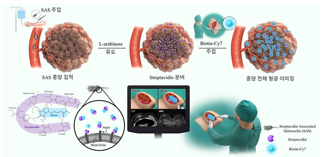 형광 가이드 수술 모식도
