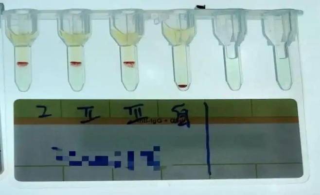 혈액 샘플. [사진출처 = 지무뉴스, 연합뉴스]