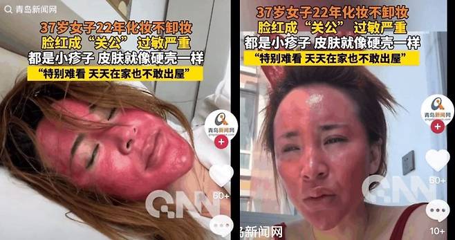 ]최근 중국 온라인 커뮤니티를 통해 22년간 화장을 제대로 지우지 않았다는 37세 여성 A씨의 사연이 전해지며 누리꾼들의 충격을 자아냈다. 출처=하오칸
