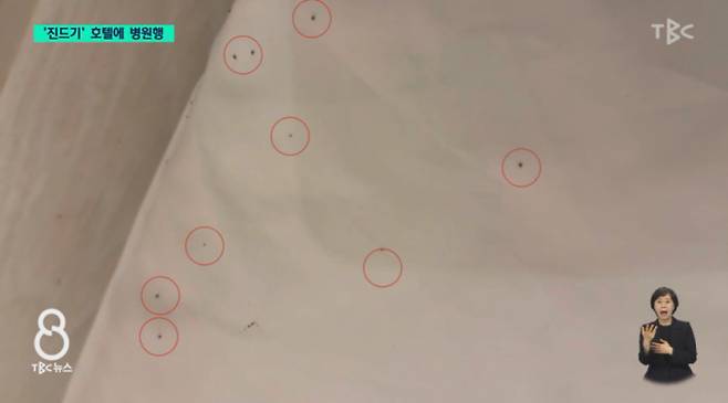 최근 대구 한 관광호텔에서 투숙한 일가족이 객실 이불 위에 붙은 진드기떼에 온 몸이 물리는 봉변을 당했다. /사진=TBC 방송캡처