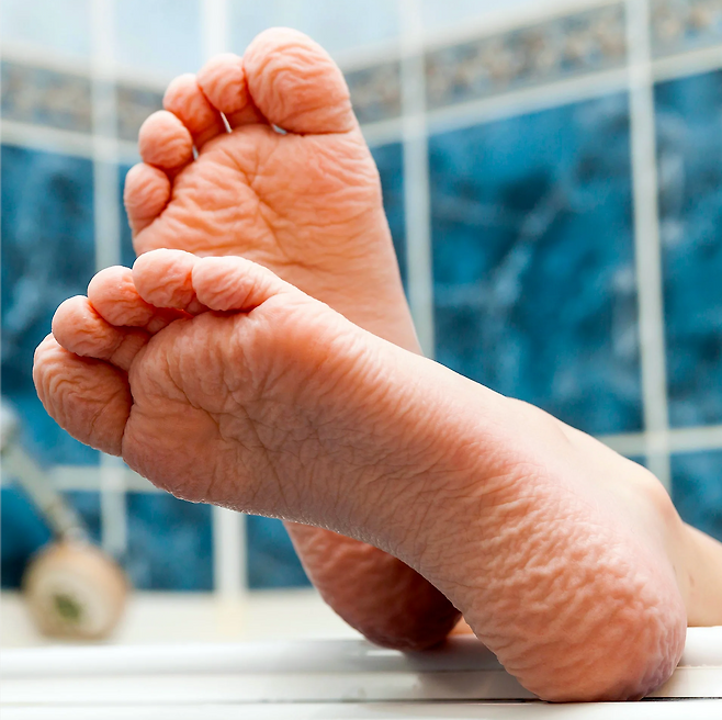 발가락과 손가락 끝 부분 피부는 물 속에 담갔을 때 쪼그라들고 주름이 생기지만, 신체의 다른 부분에서는 이러한 변화가 나타나지 않는다