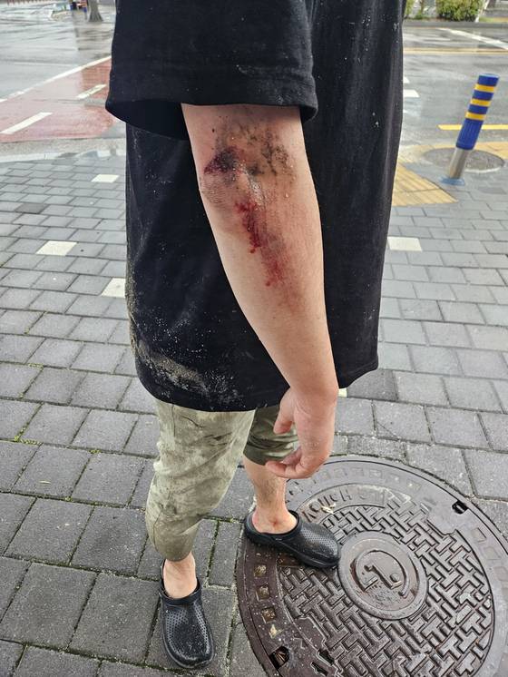 Park, 46, sustained injuries in a sinkhole accident in Namwon on June 21. [PARK]