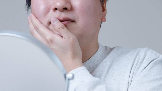 단백질 섭취가 부족하면 얼굴 부종이 생길 수 있다｜출처: 게티이미지뱅크