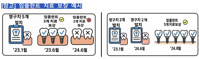 임플란트 치료 보장 예시. 금감원