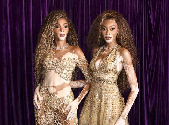 백반증 모델 위니 할로우가 25일(현지 시각) 세계 백반증의 날을 맞아 마담 투소 뉴욕에 전시된 자신의 밀랍 인형과 함께 사진을 찍고 있다./사진=뉴시스