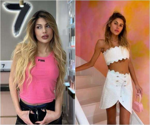 튀르키예의 유명 뷰티 인플루언서 니할 칸단(30)이 심각한 거식증을 앓다 결국 숨졌다. 인스타그램(@nihalcandann) 캡처