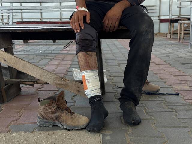 최근 가자인도주의재단이 운영하는 구호소에 식량을 구하러 갔다가 총상을 입고, 국경없는의사회 진료소에서 치료받은 팔레스타인 시민. 국경없는의사회 제공