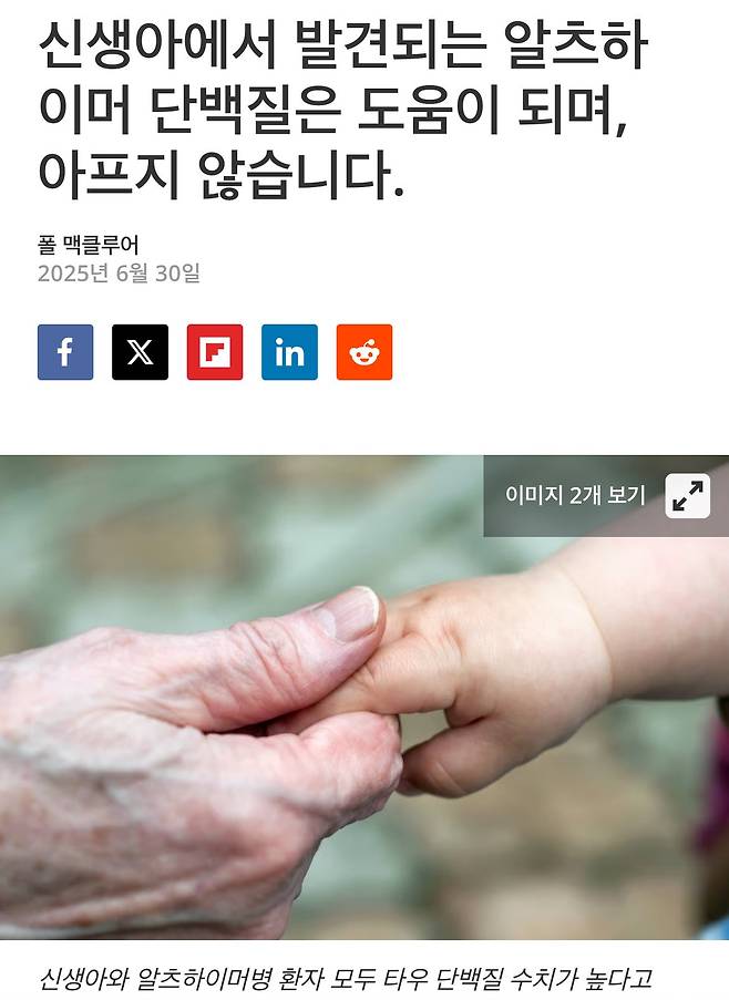 IMG_0557.jpeg 현재 알츠하이머에 대한 최초의 새로운 연구 근황