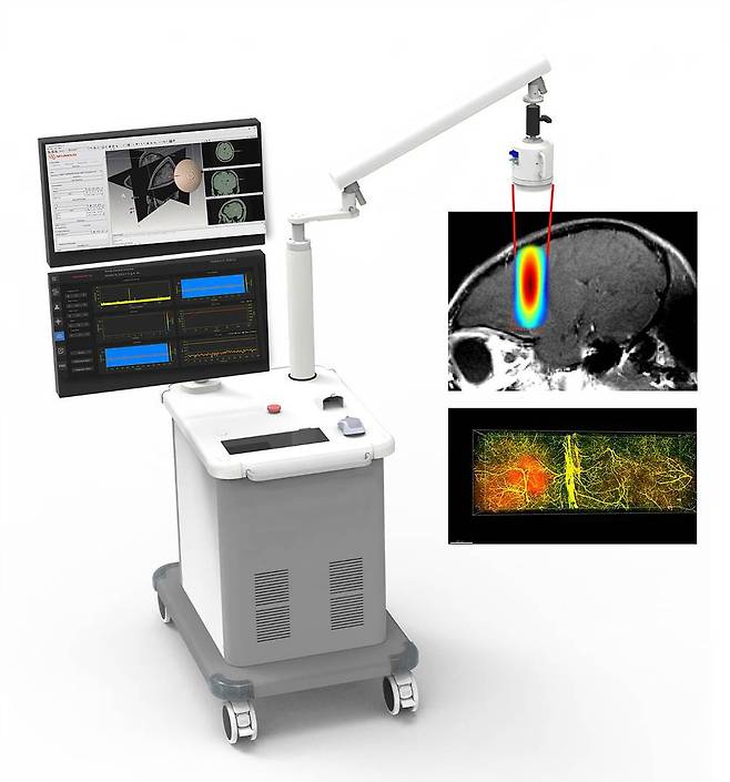 뉴머스의 집속초음파 조사 기기 / 출처=뉴머스