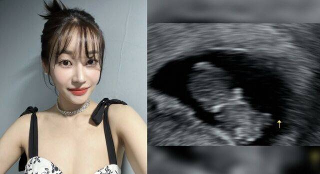 유나./ 유나 인스타그램