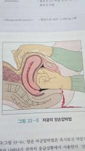 image.png 의외로 정식 응급처치 방법인 행동.jpg