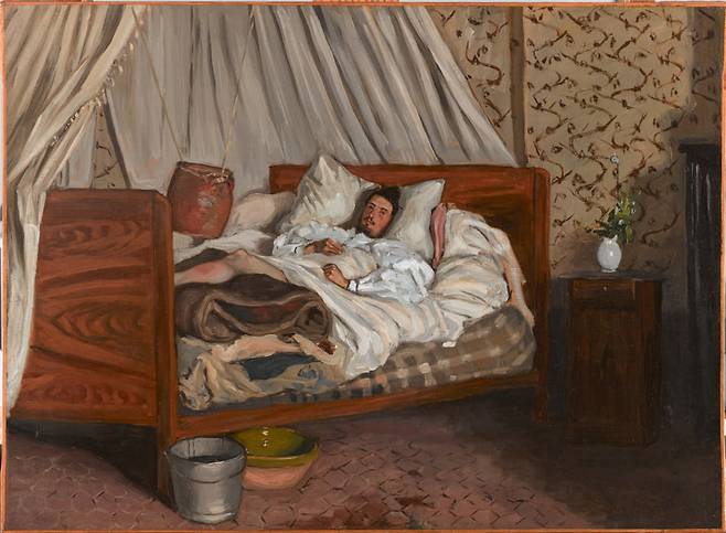 임시 야전 병원(1865). 숲에서 그림을 그리던 모네는 원반 던지기 선수들이 연습 삼아 던진 원반에 다리를 맞아 부상을 입었다. 바지유는 응급처치를 한 뒤 그를 침대에 눕혔다. 그리고 침대에 누워 회복하는 모네의 모습을 그렸다. 뒤쪽 벽지 무늬와 커튼, 인물, 침대 등 가구의 전체적인 조화가 절묘하다. /오르세미술관