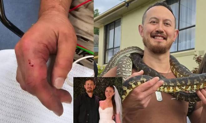 호주 멜버른에서 활동 중인 한 뱀 사냥꾼이 독사에 물린 뒤 생명을 위협받는 위기를 넘긴 것은 물론, 연인에 대한 기억을 모두 잃는 희귀한 신경학적 후유증을 겪은 사실이 알려졌다. [사진=SNS]