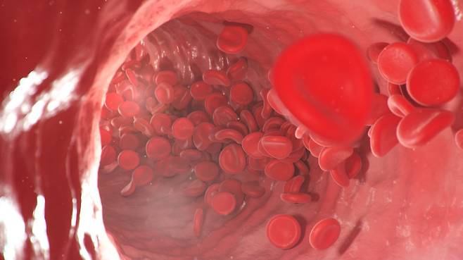 미국의 24세 남성이 정체불명의 발기부전제를 복용한 뒤 몸 곳곳에 멍이 들고, 코피와 잇몸 출혈이 멈추지 않는 등 심각한 혈액 이상 증상을 보였다. 이는 비아그라 성분이 면역성 혈소판 감소증을 유발한 첫 사례다. (사진=게티이미지뱅크)