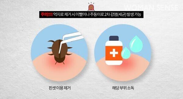 진드기가 피부에 붙어있다면 핀셋을 이용해 제거해야 하고 해방 부위는 소독약이나 비누로 깨끗이 씻어내야 한다. 사진=질병관리청