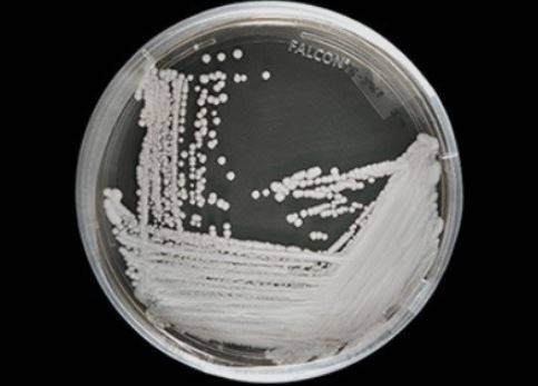 페트리 접시에서 배양된 칸디다 아우리스 균주 [사진=CDC(미국 질병통제예방센터)]