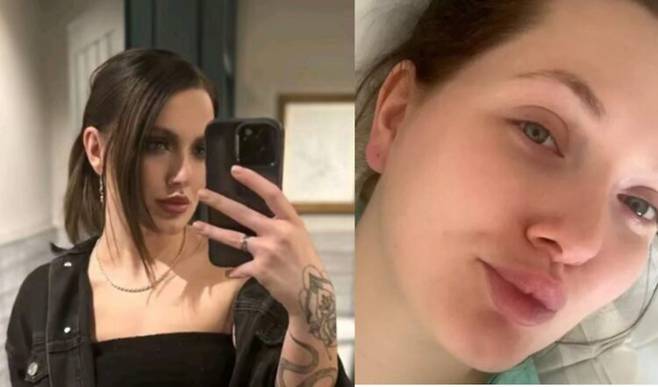 20대 초반에 한 차례 암을 이겨냈던 여성이 교통사고 후 허리통증을 겪고 뼈까지 전이된 4기 유방암 판정을 받은 사연을 공유했다. [사진=SNS]