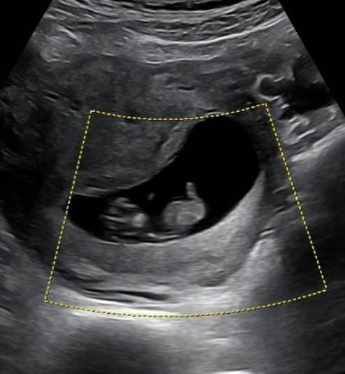 가수 KCM(본명 강창모)이 세 아이의 아빠가 된다./ 사진=KCM SNS