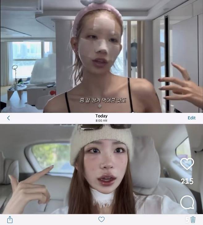 [서울=뉴시스] 최준희가 지난 7일 본인 인스타그램에 광대, 눈 성형수술 후기를 밝혔다. (사진=최준희 인스타그램 캡처) 2025.07.08. photo@newsis.com *재판매 및 DB 금지