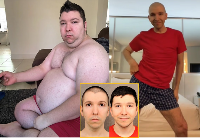 극단적인 비만으로 유명세를 얻었던 미국의 유명 먹방 유튜버 니코카도 아보카도(본명 니콜라스 페리·32)가 약 113kg 감량 이후 남은 처진 피부를 제거하기 위해 대규모 성형수술을 받은 사실을 공개했다. 하단 사진= 처진 피부 개선(우측) 후 비교 모습 [사진=니코카도 유튜브]