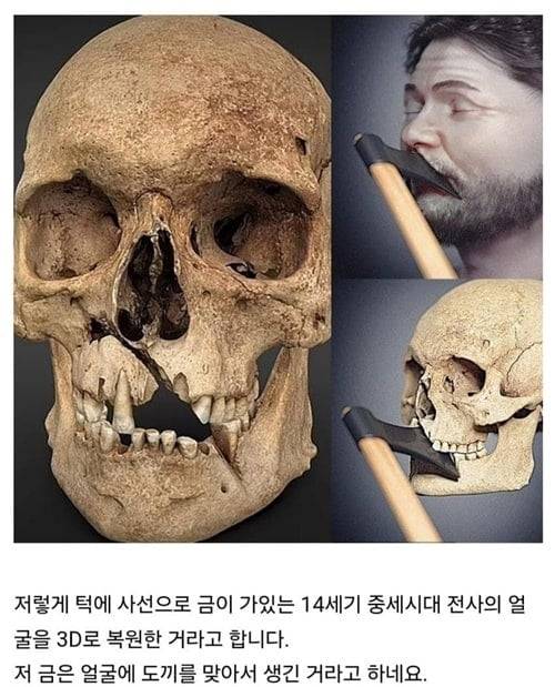 도끼 맞고 죽은 바이킹 전사 해골