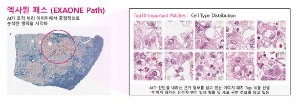 엑사원 패스는 전체 슬라이드 이미지(WSI)에서 암과 관련된 유전자 변이를 예측할 수 있다. [사진=LG]