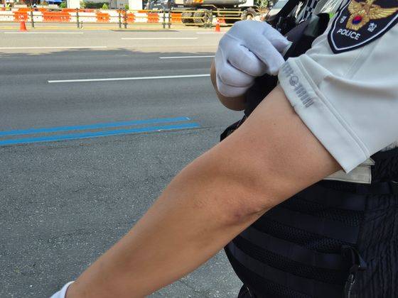 9일 오전 10시쯤 서울 강남구 청담동 경기고 사거리 인근에서 서울 강남경찰서 한주현 경사(35)가 교통 단속을 하다 까맣게 탄 팔 소매를 들어보이고 있다. 오소영 기자