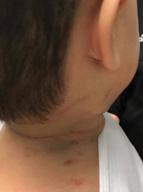 [서울=뉴시스] 미국 생후 15개월 남아가 누나의 머리카락에 목이 감겨 의식을 잃는 사고가 발생했다. 당시 아이의 모습. (사진 = 큐어어스 캡처) 2025.07.10.  *재판매 및 DB 금지