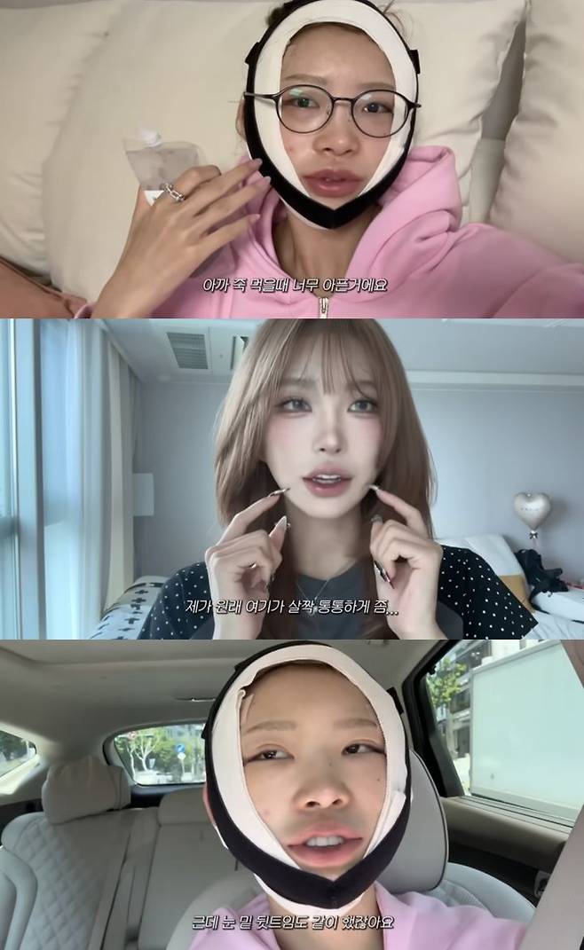 [서울=뉴시스] 최준희가 지난 8일 유튜브 채널 '준희'에  안면 윤곽, 눈 밑 뒷트임 성형수술 후기를 밝혔다. (사진=유튜브 채널 '준희' 캡처) 2025.07.11. photo@newsis.com  *재판매 및 DB 금지