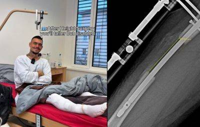 키를 늘리기 위해 연장 수술을 받은 레온 오트렘바 [이미지 출처=사회관계망서비스(SNS) 캡처]