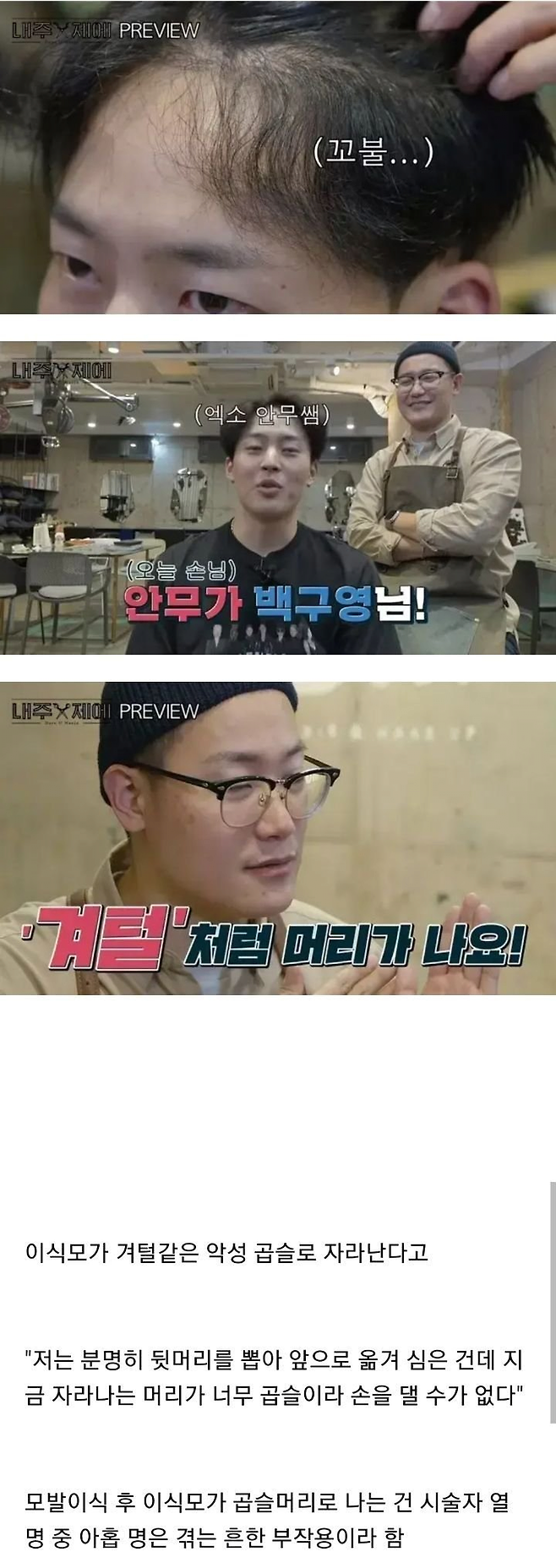 image.png 모발이식수술 부작용.jpg