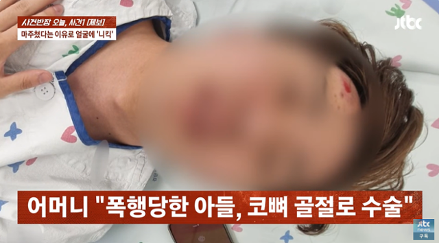지난달 16일 인천 공영주차장에서 중년 남성에게 폭행 당한 고3 학생이 병원에 입원해 있다. JTBC '사건반장' 캡쳐