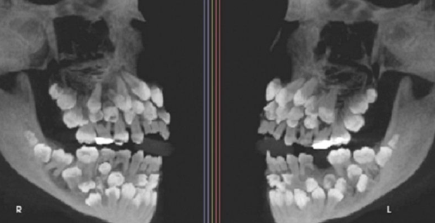 ⓒVN익스프레스 갈무리