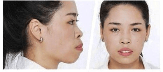 24b0d121e09c28a8699fe8b115ef046f56449b96a1