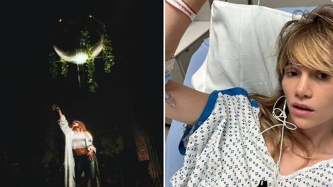 영국 배우 겸 가수 스키 하우스워터(33)가 스키니 팬츠를 입었다 탈장이 생겼다고 고백했다. [사진='Suki Waterhouse' SNS]