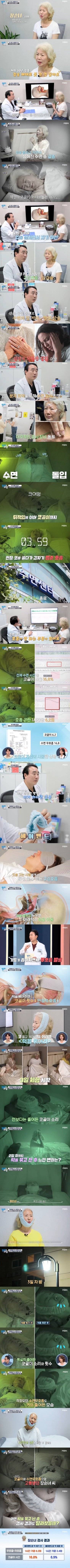 IMG_3383.jpeg 비염, 코골이, 수면무호흡증을 극복한 70살 여자 ㄷㄷㄷㄷㄷ